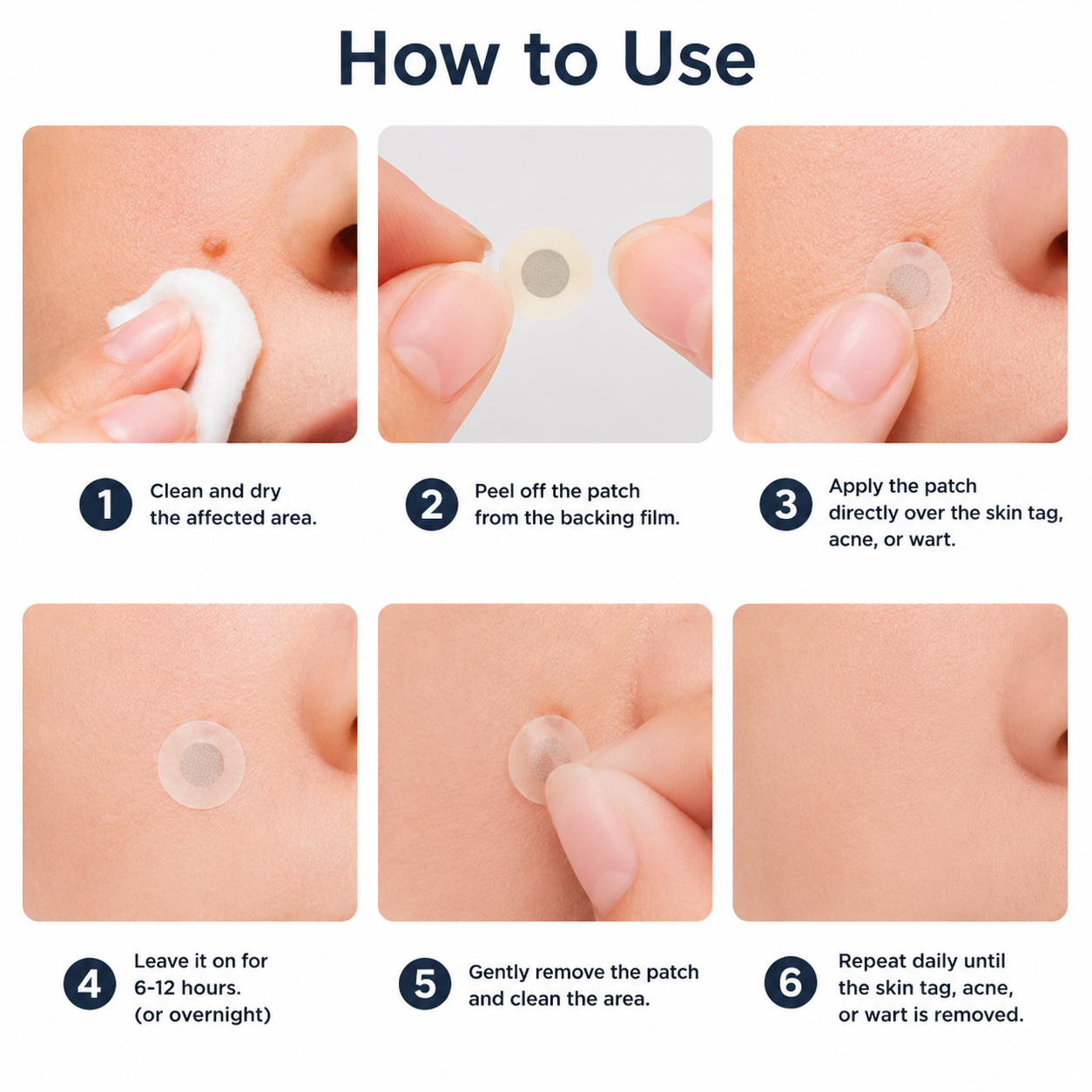 🔥 Curalona®2-in-1 Microneedle & Hydrocolloid Patch🍀| Removes Raised Moles, Acne, Flat Warts & Skin Tags | Helps Improve Wrinkles, Scars & Blemishes | Invisible Patches for Face & Body