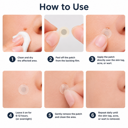 🔥 Curalona®2-in-1 Microneedle & Hydrocolloid Patch🍀| Removes Raised Moles, Acne, Flat Warts & Skin Tags | Helps Improve Wrinkles, Scars & Blemishes | Invisible Patches for Face & Body