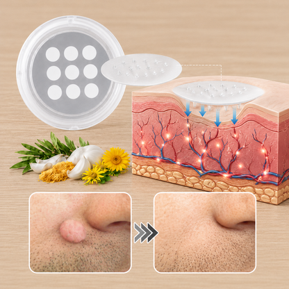 🔥 Curalona®2-in-1 Microneedle & Hydrocolloid Patch🍀| Removes Raised Moles, Acne, Flat Warts & Skin Tags | Helps Improve Wrinkles, Scars & Blemishes | Invisible Patches for Face & Body